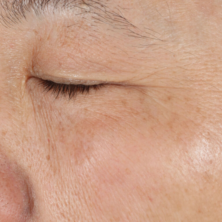 After using Mary Kay Vitamin C+E Serum on eye area